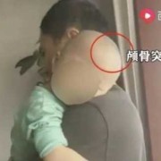 为什么我家宝宝会头大身子小？是什么原因啊,胎儿头大是怎么回事呢