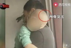 为什么我家宝宝会头大身子小？是什么原因啊,胎儿头大是怎么回事呢