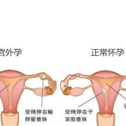 孕32周肚子隐隐作痛怎么回事,孕早期小腹隐隐作痛,但没有出血现象