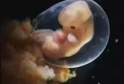 怀孕八周孕囊多大正常,胎儿八周发育图片