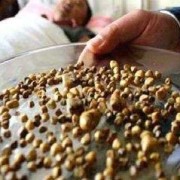 孕期有肾结石（孕妇有肾结石怎么办）