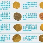 胎儿的胎粪怎么排出，用什么方法好呢,胎儿的粪便在母体内排哪