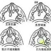 孕期乳头有透明液体（怀孕乳头分泌透明液体怎么回事）