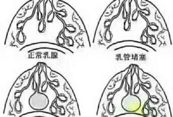 孕期乳头有透明液体（怀孕乳头分泌透明液体怎么回事）
