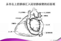 胎儿永存左上腔静脉是什么意思,四维检查胎儿永存左上腔静脉是什么意思