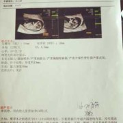 怀孕12周胎儿成型了吗（孕妇做nt检查多少钱，NT检查是检查什么的）