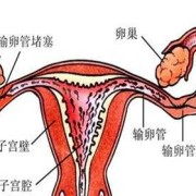 胎儿是生活在（  ） ，A．输卵管，B．子宫，C．卵巢，D．阴,胎儿卵巢囊肿是什么原因引起的