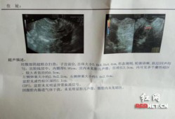 孕妇系统B超具体检查内容,B超看孕期误差最多多少天