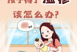 孕妇得了湿疹怎么办,孕期吃新生儿湿疹怎么办啊
