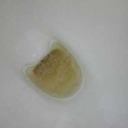 孕期尿蛋白一个加号（从怀孕33周到38周一直尿蛋白1+）