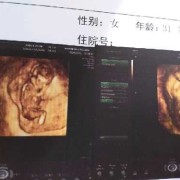 孕44天胎儿（孕44天胎儿发育情况）