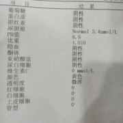孕期尿检指标（孕期尿检指标怎么看）
