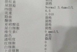 孕期尿检指标（孕期尿检指标怎么看）