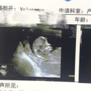 胎儿鼻子发育（胎儿鼻子发育多少周）