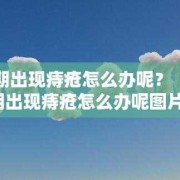 痔疮是如何产生的,孕期痔疮原因有哪些