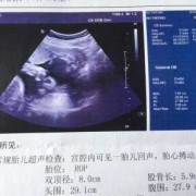 胎儿偏小3周问题大吗（胎儿偏小3周问题大吗正常吗）
