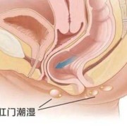 怀孕屁股痒怎么回事,孕妇一到晚上肛门瘙痒
