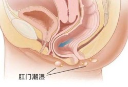 怀孕屁股痒怎么回事,孕妇一到晚上肛门瘙痒