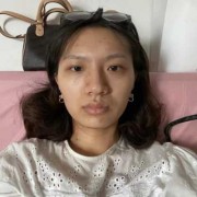 孕期皮肤发黄（孕期皮肤发黄正常吗）