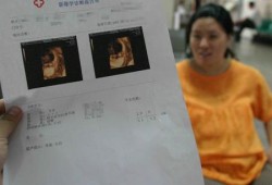 17周的b超单显示胎儿原因脊柱不清,胎儿不正常孕妇有什么表现