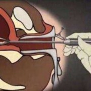 引产胎儿如何处理（引产胎儿如何处理最好）