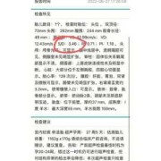 胎儿sd值偏高怎么回事（孕32周、检查出SD值高，达到3，是不是宝宝会危险）