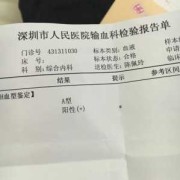 孕期rh血型阳性（血型鉴定阳性是什么）