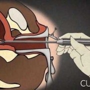 堕胎后真的有婴灵存在吗,引产孩子灵魂去哪里了