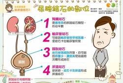 孕期结石（孕期结石疼怎么办）