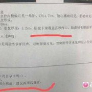 胎儿未见颅骨光环（胎儿未见颅骨光环）