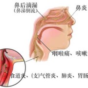 怀孕期间鼻炎犯怎么办（怀孕鼻炎犯了怎么办可不可以用药，会不会对胎儿造成影响）