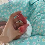 52天胎儿（52天胎儿有多大图片）