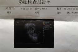 孕多少周检查胎儿心脏（怀孕50天，胎儿心跳搏动113次/分，正常吗）