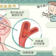 儿童缺血灶怎么办,胎儿脑缺血是什么导致的
