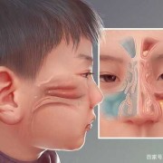 孕妇鼻炎会遗传胎儿吗（孕妇鼻炎会遗传胎儿吗视频）
