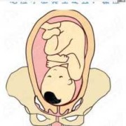 胎儿rop（胎儿rop）