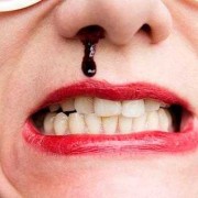 孕妇经常流鼻血是怎么回事,孕期经常流鼻血是什么原因