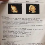 胎儿心脏发育过程（做四维彩超能检测出孩子的心脏问题吗）