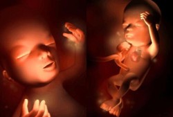 胎儿在子宫里的位置（孕14周子宫在哪个位置？怀孕早期要注意什么事项呀）