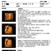 如何看四维单上的数据,四维彩超如何看胎儿性别