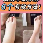 孕妇脚浮肿怎么缓解?怀孕九个多月，水肿很厉害有什么办法能改善,孕期肾水肿怎么办