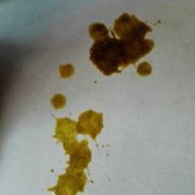 孕期漏屎（猫咪突然漏屎在地板上，求解怎么回事）