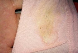 孕期乳头变大（孕期乳头变大了是什么情况）