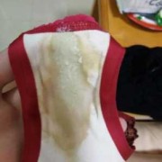 怀孕后白带会增多吗,