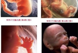 怀孕3周真实胎儿图片（怀孕3周真实胎儿图片大全）