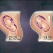 28周的宝宝在肚子哪个位置,28周胎儿位置低怎么办
