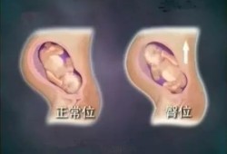 28周的宝宝在肚子哪个位置,28周胎儿位置低怎么办
