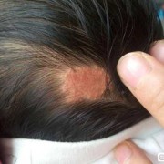 胎儿几个月开始长皮肤（胎儿几个月开始长皮肤颜色）