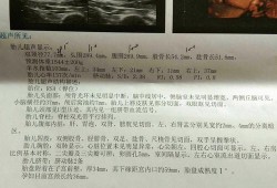 右肾分离的胎儿是男孩（右肾分离的胎儿是男孩）