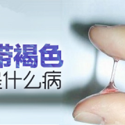 孕妇白带发黄什么原因,孕期皮肤变黄是什么原因